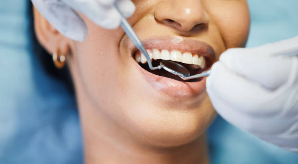 Best Root Canal Emergency Dentist  in Zephyrhills, FL
